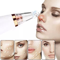 Succionador de Poros para Limpieza Facial Profunda